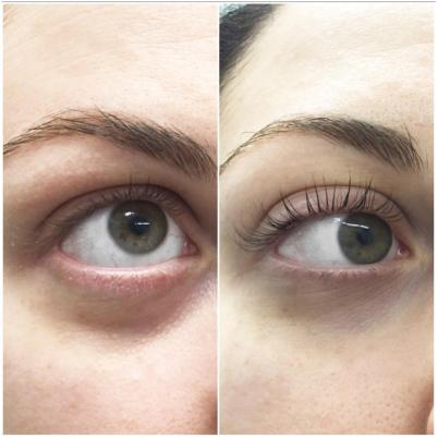 lash lifting